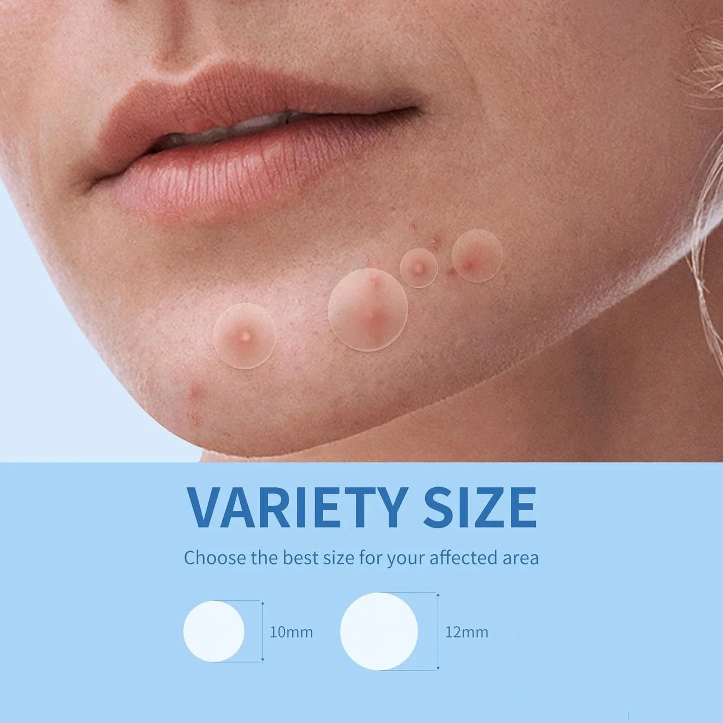 Utopic Health™ Face Acne Patch 360pcs